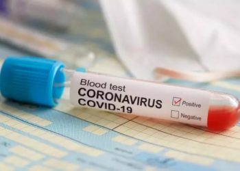 Hasil Swab, Satu Peserta Jamaah Ijtima Gowa Asal Lolak Negatif Covid-19