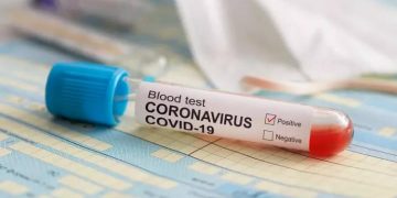 Hasil Swab, Satu Peserta Jamaah Ijtima Gowa Asal Lolak Negatif Covid-19