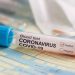 Hasil Swab, Satu Peserta Jamaah Ijtima Gowa Asal Lolak Negatif Covid-19