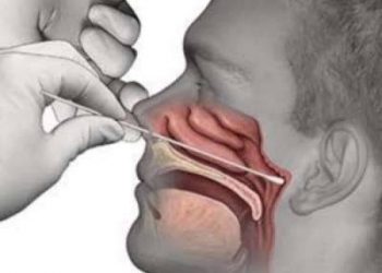 Memakamkan Pasien Covid-19 Tanpa Protokoler Kesehatan, Puluhan Warga Bakan di Swab Test