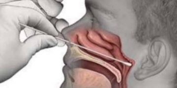 Memakamkan Pasien Covid-19 Tanpa Protokoler Kesehatan, Puluhan Warga Bakan di Swab Test
