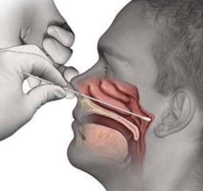 Memakamkan Pasien Covid-19 Tanpa Protokoler Kesehatan, Puluhan Warga Bakan di Swab Test