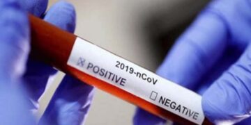 Data Satgas Provinsi, Kasus Positif Covid-19 Bolmong Meningkat