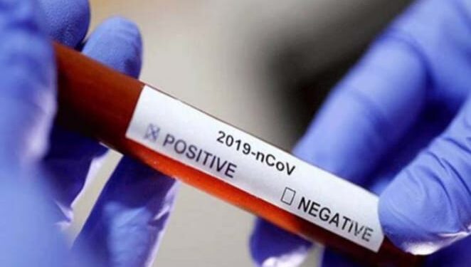 Data Satgas Provinsi, Kasus Positif Covid-19 Bolmong Meningkat