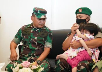 Serda Fredrik Haru Putri Kembar Siamnya Dijenguk KSAD