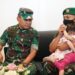 Serda Fredrik Haru Putri Kembar Siamnya Dijenguk KSAD